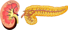 Kombinált vese- hasnyálmirigy vese hasnyálmirigy icon3